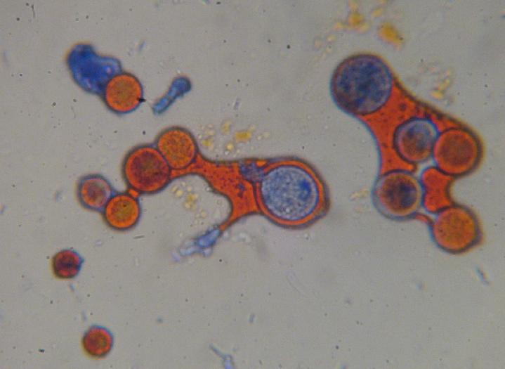 Haematococcus Spores Stained